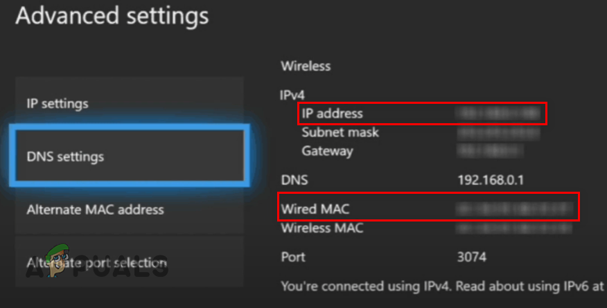 Finding the IP and MAC Address of your Xbox Series S/X