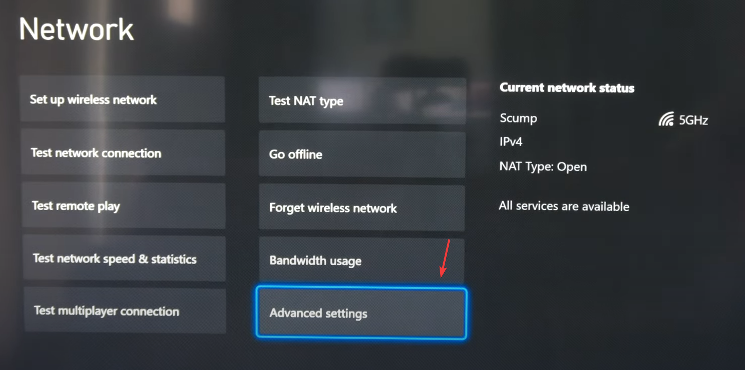 Xbox network settings menu
